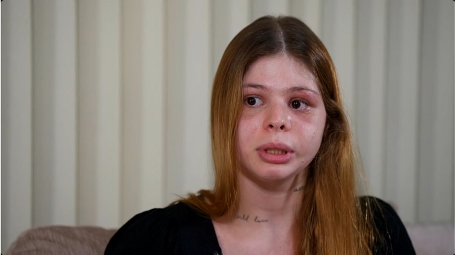 “Quase me mata no meu aniversário”, relata médica após agressão do namorado