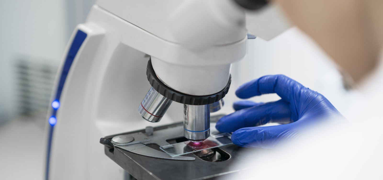 Doador de sêmen transmite mutação ligada a câncer grave a quase 200 crianças na Europa