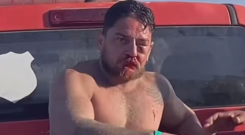 Casal de turistas é agredido em Porto de Galinhas após desacordo sobre cobrança de cadeiras