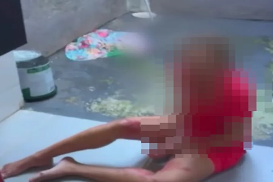 Mulher cai de prédio ao tentar escapar de agressões do marido; polícia investiga o caso