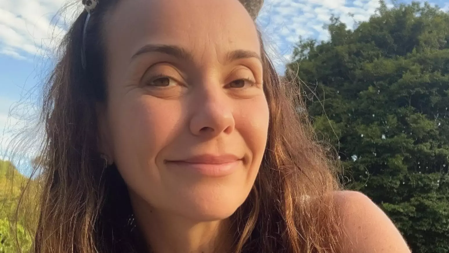 Atriz de ‘Chiquititas’, Flávia Monteiro é internada após acidente doméstico e passa por cirurgia