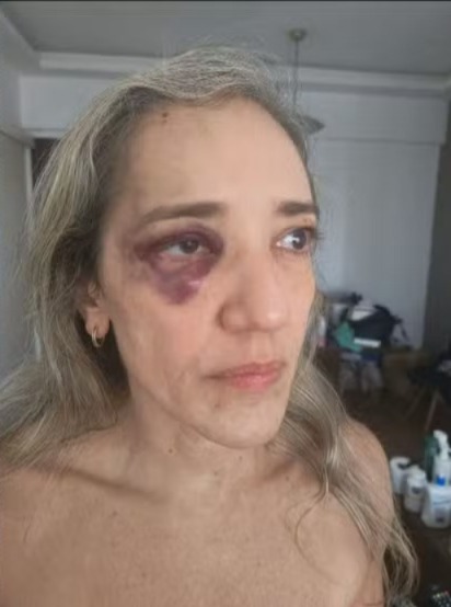 Mulher é agredida por motociclista de aplicativo após questionar condições de segurança durante corrida