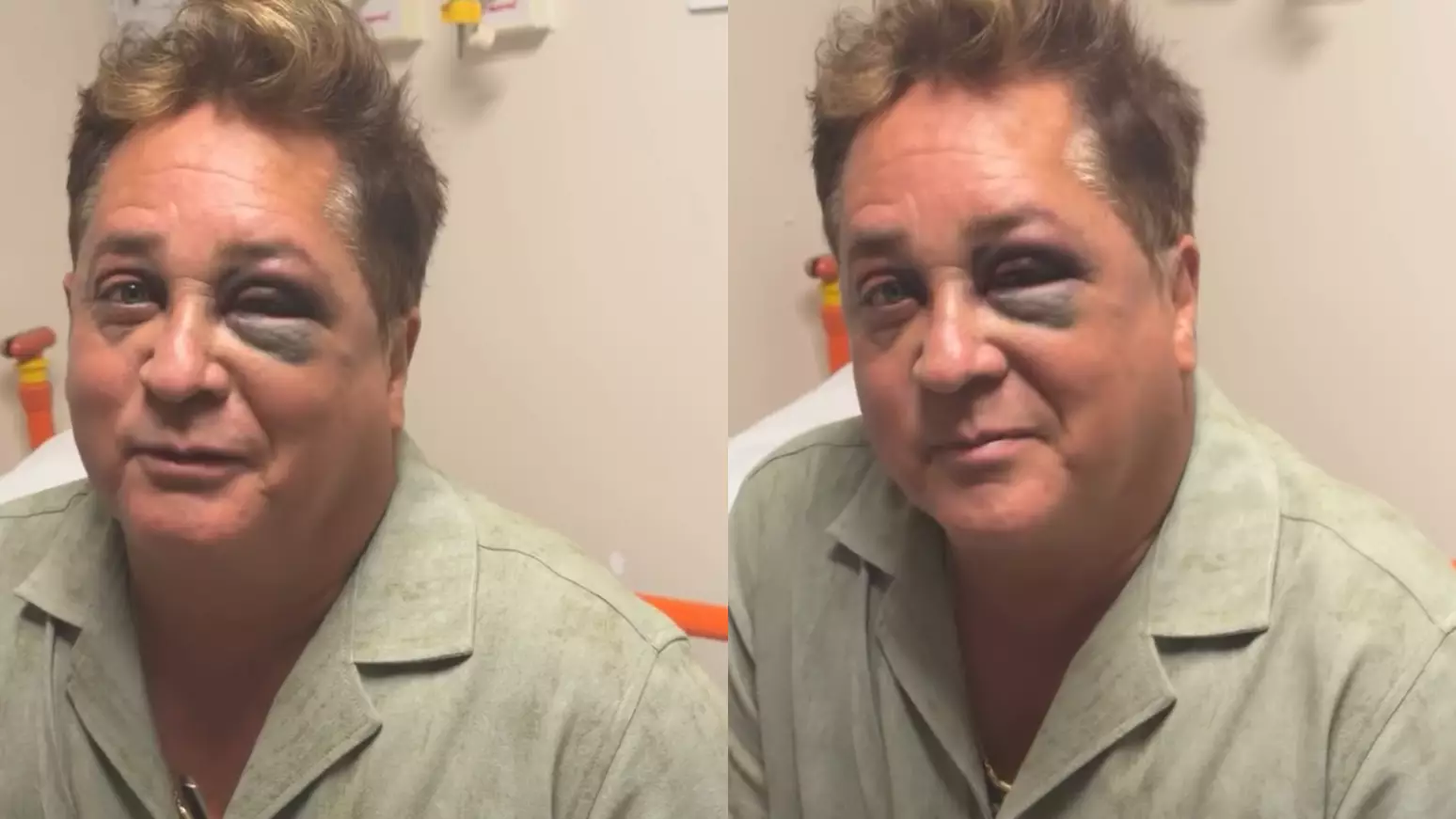 Leonardo revela fratura no rosto após acidente durante pescaria no Pantanal
